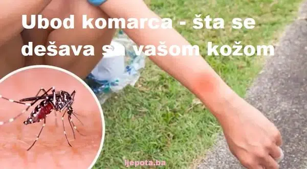 Ubod Komarca – Sta Se Dogada Sa Vasom Kozom