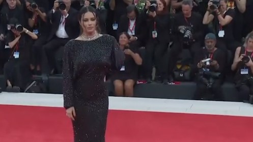 Lima Plijenila Svojom Ljepotom Iako Joj Neki Porucuju Da ‘Ne