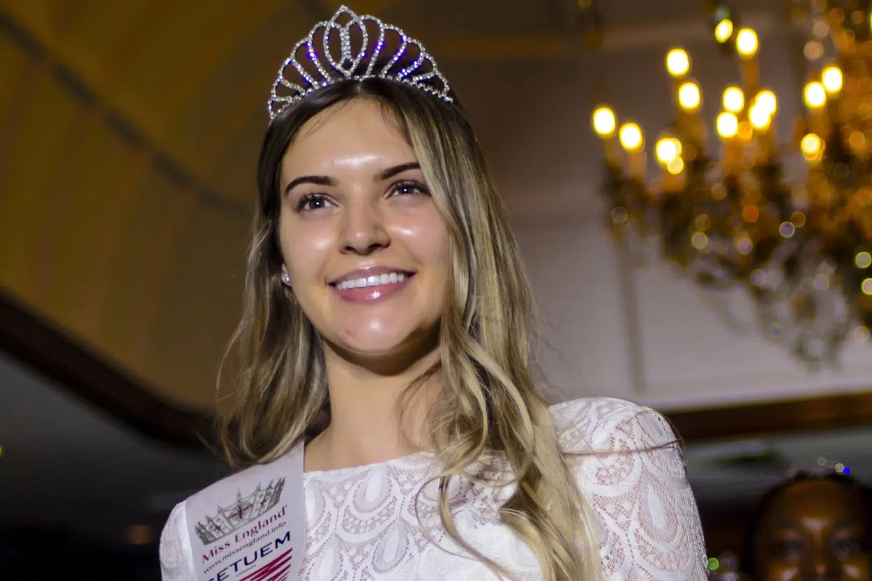 Održan prvi svjetski izbor za Miss bez šminke: pobijedila je 26-godišnja Nataša
