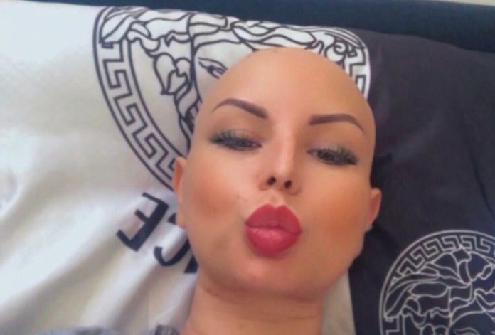 Teski Izazovi Za Pjevacicu Godinama Boluje Od Raka A Tvrdi