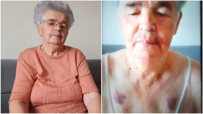 1704629066 Hasiju 81 Pretukli Zbog 20 Maraka Uhvatio Me Za Vrat