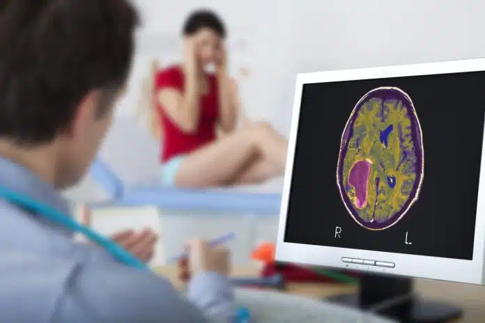 Kako Sam Saznala Da Imam Tumor Na Mozgu Prica O