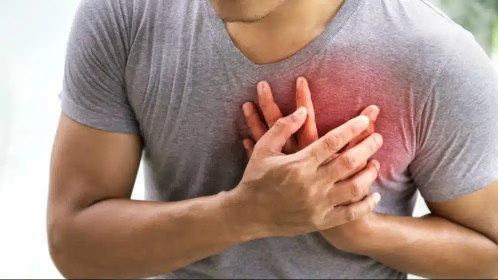 TRI NAMIRNICE ZAČEPLJUJU ARTERIJE: EVO ŠTA KAŽE NUTRICIONISTA O NJIMA