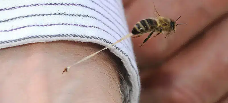 Kako postupiti kada vas ugrize pčela, osa, bumbar ili stršljen, a imate alergiju
