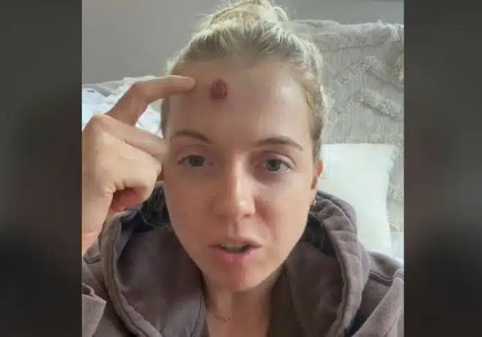 (VIDEO) BIOPSIJA POTVRDILA NAJGORE Mlada majka mislila da joj je
