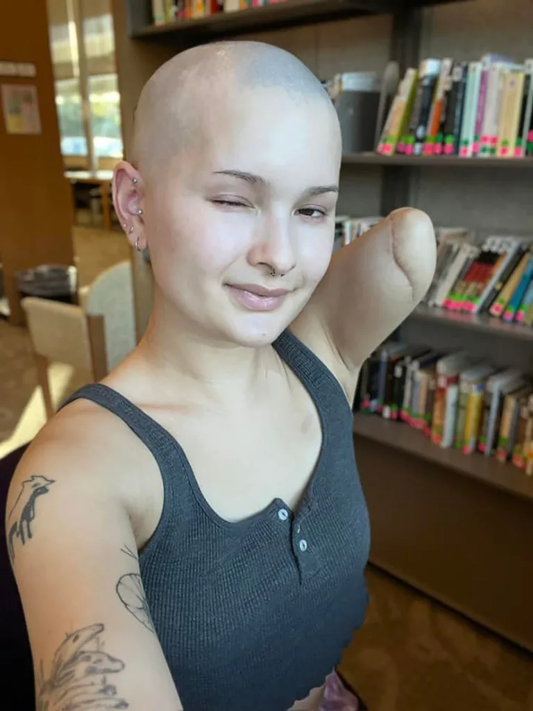 Ova žena postala je simbol snage! Za 3 godine rak joj se vratio 3 puta i ona ga je svaki put nokautirala