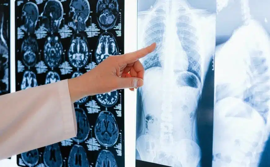Oprez: Ovako tijelo upozorava da se stvara tromb – evo gdje sve može nastati