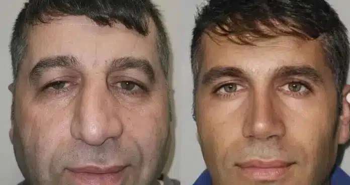 Čovjek nakon plastičnih operacija postao je hit na Internetu: