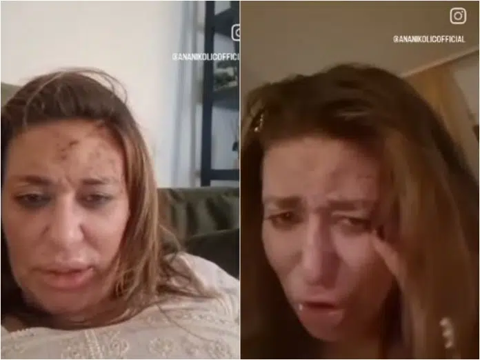 Opet pretučena Ana Nikolić, objavila snimku od koje se diže